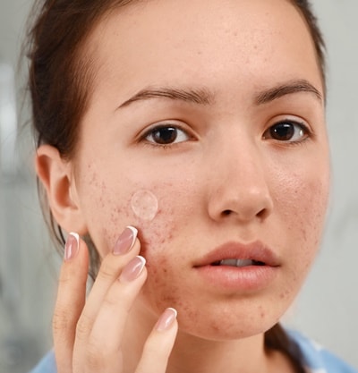 Cuidados Pós-Uso: Deixando Sua Pele Ainda Melhor - inspiração 1