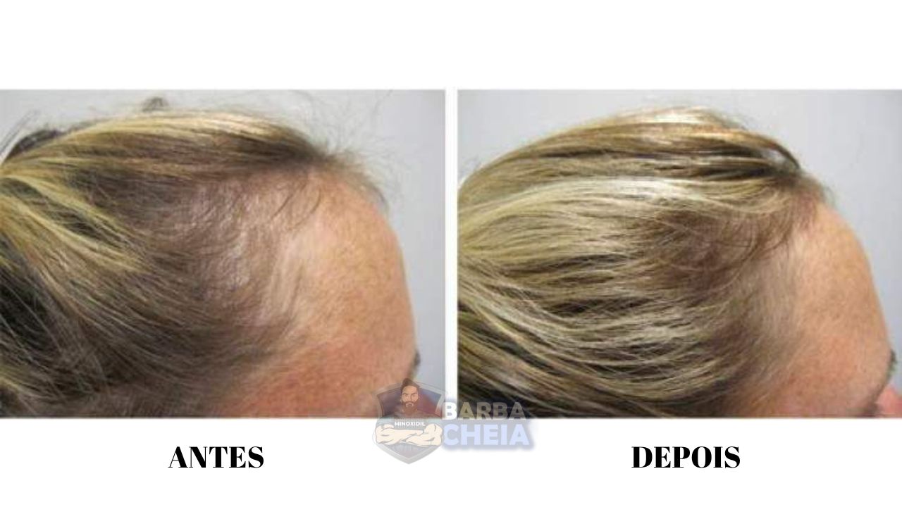 Considerações Adicionais: Fatores Que Influenciam o 'Depois' - inspiração 2