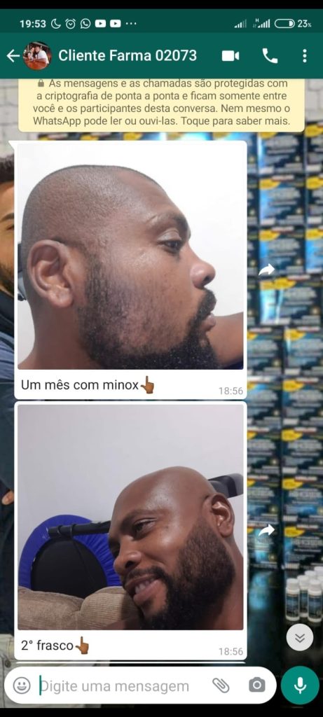 Variações no Crescimento: Por Que Seu Cabelo Pode Reagir Diferente? - inspiração 1