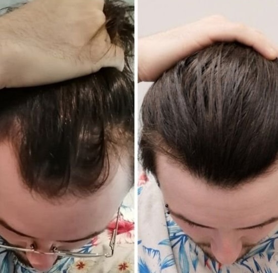 Variações no Crescimento: Por Que Seu Cabelo Pode Reagir Diferente? - inspiração 2
