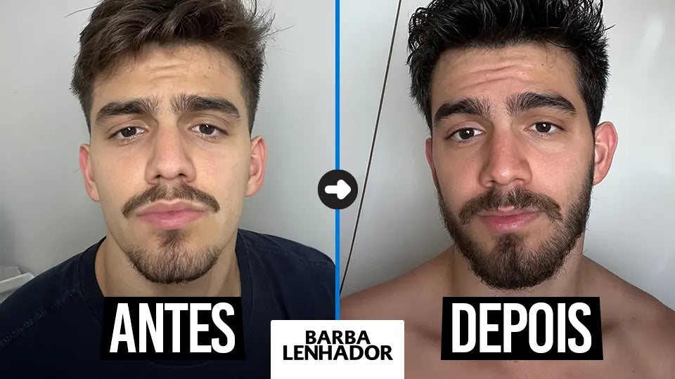 A Fase de Shedding: Entendendo a Perda Temporária de Fios - inspiração 1