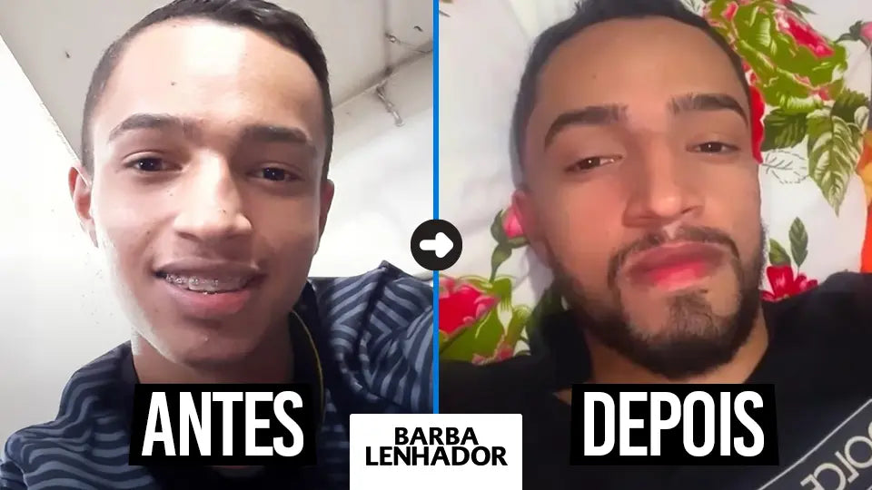 Comparando Antes e Depois: O Que Fotografias Podem Revelar? - inspiração 1