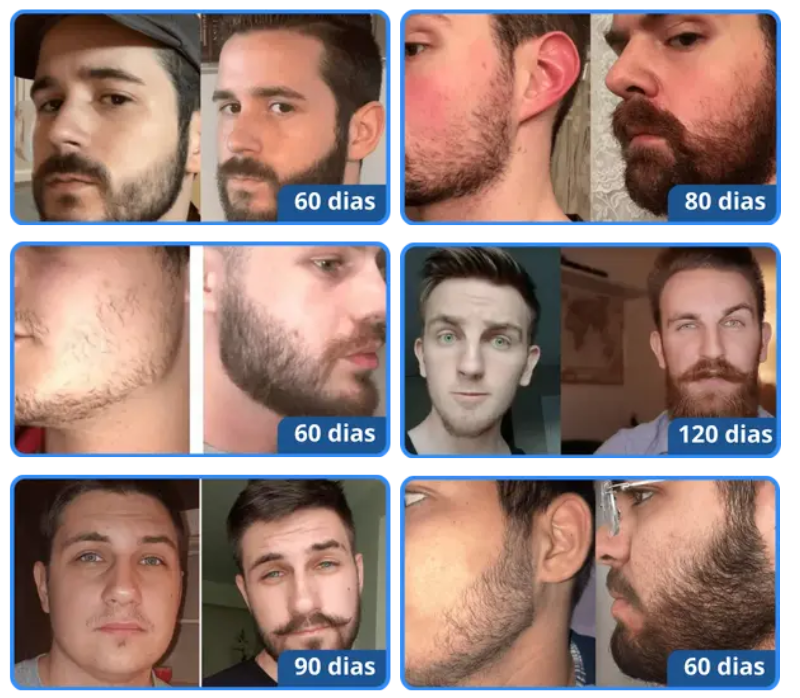 Comparando Antes e Depois: O Que Fotografias Podem Revelar? - inspiração 2