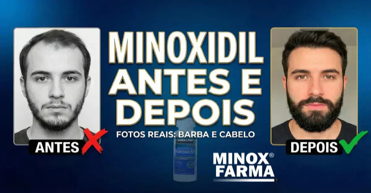 Avaliação do Couro Cabeludo: Onde o Crescimento é Mais Evidente? - inspiração 1