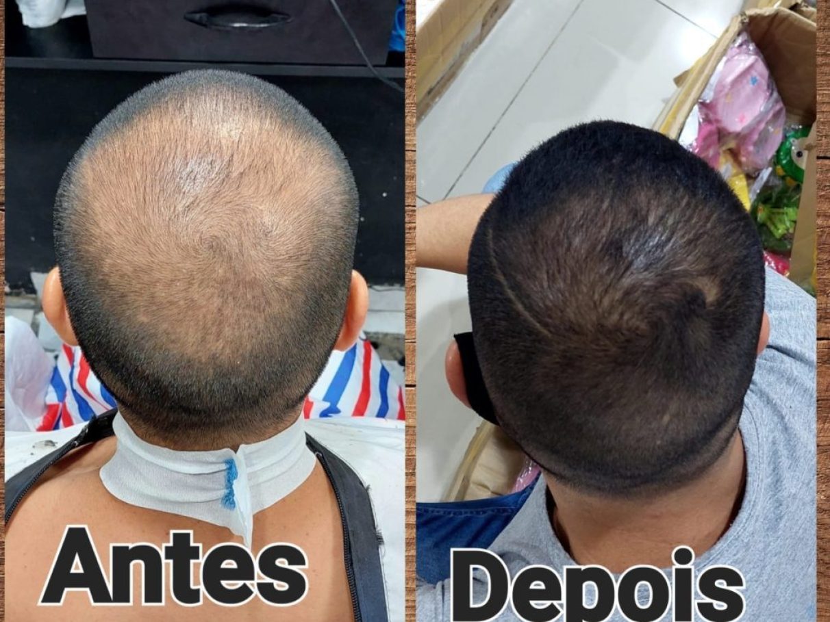 As Primeiras Mudanças Visíveis: O Que Esperar nas Semanas Iniciais - inspiração 2