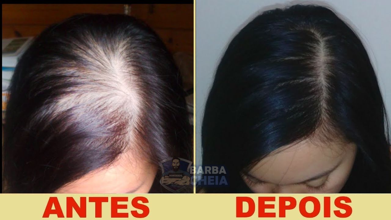 Fortalecimento Capilar: Menos Queda e Mais Densidade - inspiração 2