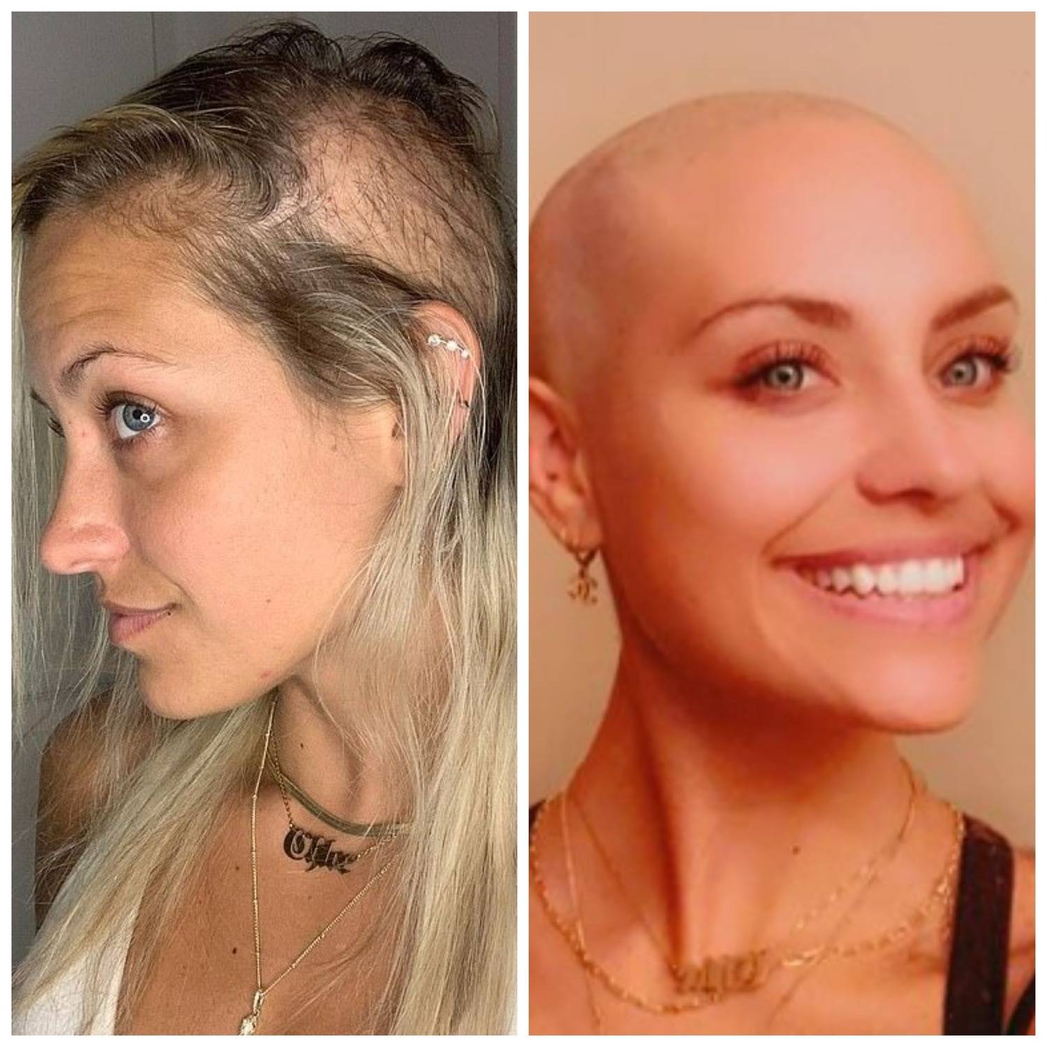 Comparando Fotos: A Evolução Clara do 'Antes e Depois' - inspiração 2