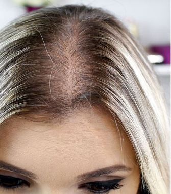 Resultados a Longo Prazo: Manutenção e Consistência Importam - inspiração 2