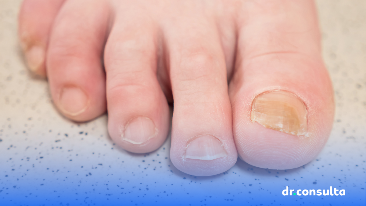 rotina de cuidados para unhas sempre brancas