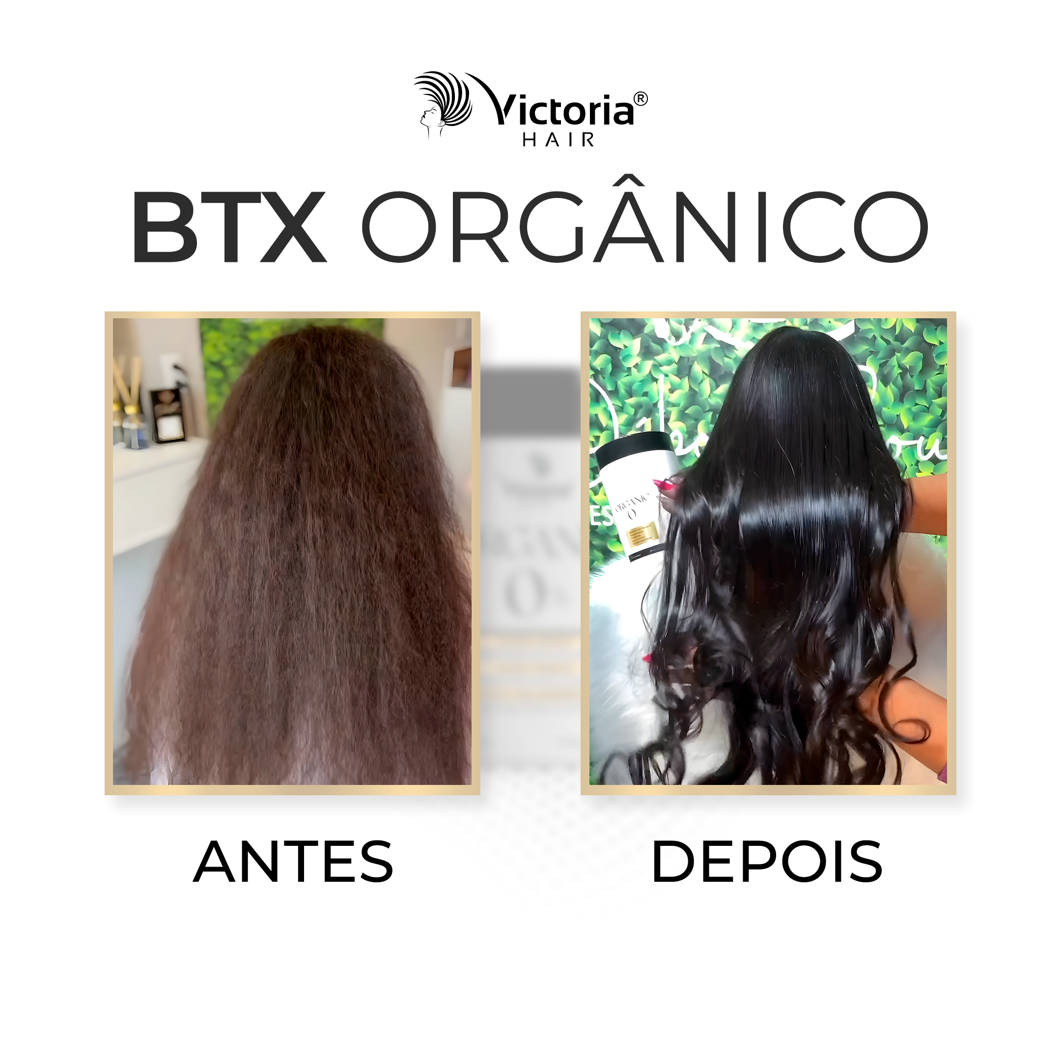 antes e depois botox