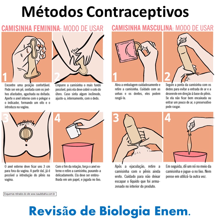 implante e DIU
3. Anticoncepcionais não hormonais: opções seguras sem hormônios
4. Eficácia dos métodos contraceptivos: comparativo com dados reais
5. SUS e anticoncepcionais: como acessar métodos gratuitos