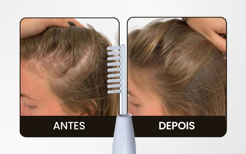 Aparelho de alta frequência capilar preço
