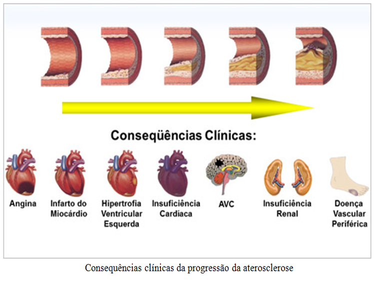 Exames Essenciais para Diagnosticar Doenças das Artérias Precocemente