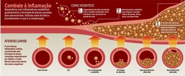 HDL e seu Impacto na Saúde Arterial