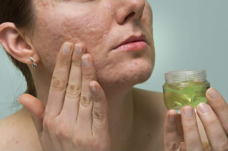 Mitos e verdades sobre o uso da babosa na pele