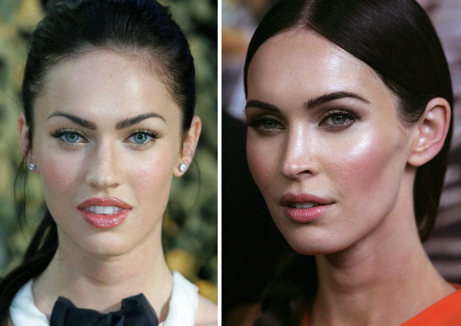 5 ideias de títulos:
1. Bichectomia: O Que Você Precisa Saber Antes de Fazer
2. Antes e Depois da Bichectomia: Expectativas vs. Realidade
3. Riscos e Complicações da Bichectomia: O Que os Pacientes Relatam
4. Bichectomia: É Possível Reverter os Efeitos?
5. Harmonização Facial: A Bichectomia é a Escolha Certa Para Você?