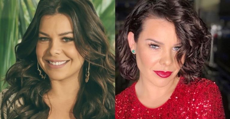 Bichectomia Antes E Depois