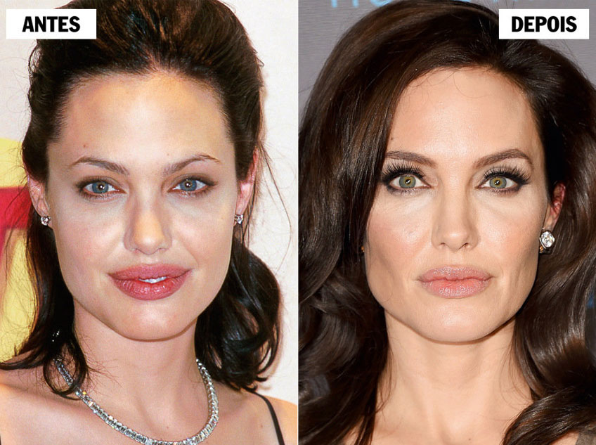 5 ideias de títulos:
1. Bichectomia: O Que Você Precisa Saber Antes de Fazer
2. Antes e Depois da Bichectomia: Expectativas vs. Realidade
3. Riscos e Complicações da Bichectomia: O Que os Pacientes Relatam
4. Bichectomia: É Possível Reverter os Efeitos?
5. Harmonização Facial: A Bichectomia é a Escolha Certa Para Você?