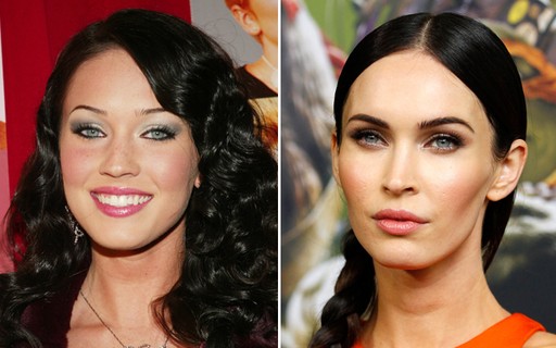 5 ideias de títulos:
1. Bichectomia: O Que Você Precisa Saber Antes de Fazer
2. Antes e Depois da Bichectomia: Expectativas vs. Realidade
3. Riscos e Complicações da Bichectomia: O Que os Pacientes Relatam
4. Bichectomia: É Possível Reverter os Efeitos?
5. Harmonização Facial: A Bichectomia é a Escolha Certa Para Você?