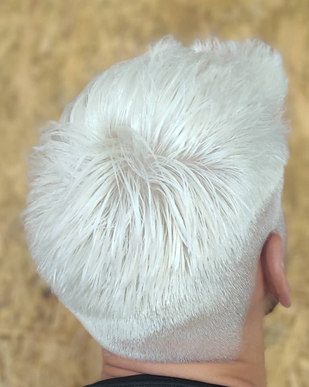 1. Guia Completo de Cuidados para Cabelo Nevou Feminino
2. Cabelo Nevou em Cabelos Cacheados e Afros: Dicas e Inspirações
3. Buzz Cut Platinado Feminino: Ousadia e Estilo com o Efeito Nevou
4. O Processo de Descoloração para o Nevou: Passo a Passo e Precauções
5. Cronograma Capilar Essencial para Manter a Saúde do Cabelo Nevou
6. Nevou em Casa ou no Salão? Prós e Contras da Descoloração Platinada