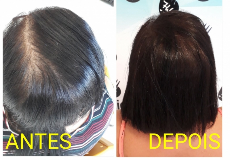 Guia Completo: Como Vender Seu Cabelo Natural e Maximizar o Lucro; Corte de Cabelo Feminino: Desvendando os Preços em Salões de Luxo vs. Populares; Mega Hair: Entenda o Custo do Cabelo Humano por Comprimento e Tipo de Fio; Penteados para Eventos: Quanto Custa um Penteado de Noiva e Outras Ocasiões Especiais?; Cabelo Virgem vs. Cabelo Quimicamente Tratado: Qual a Diferença de Valor no Mercado?