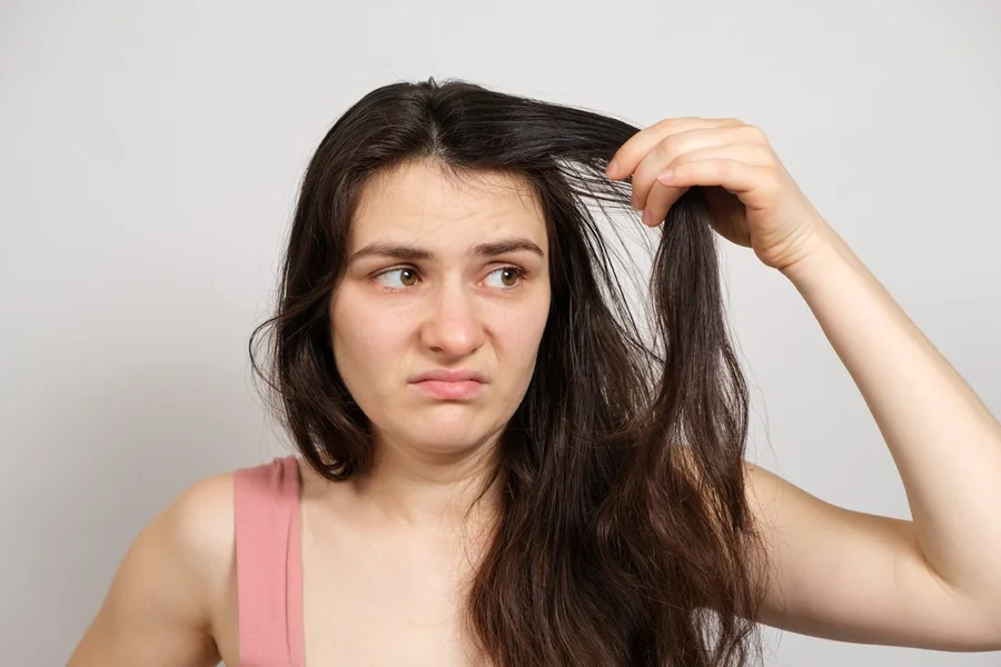 Os perigos ocultos do cabelo sujo: doenças e problemas de pele