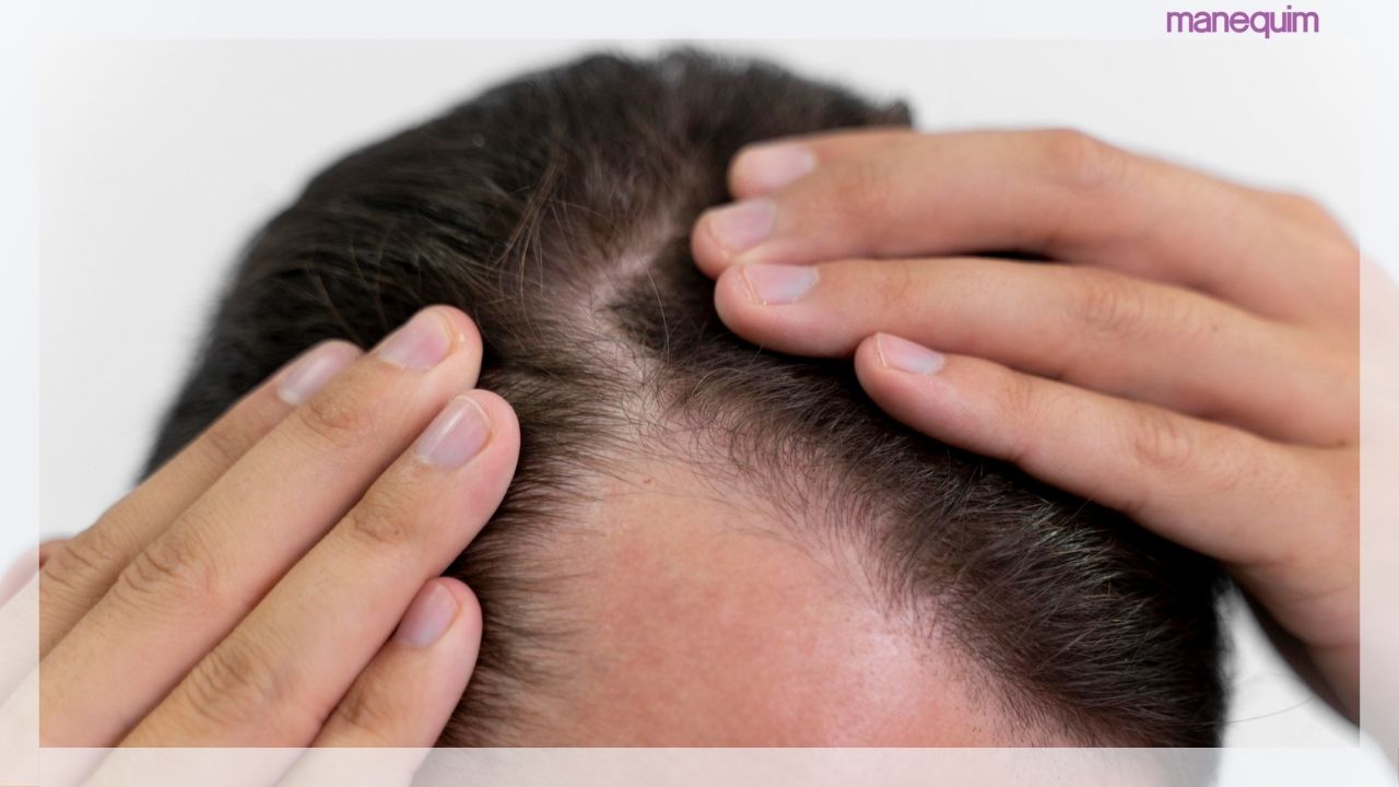 Os perigos ocultos do cabelo sujo: doenças e problemas de pele
