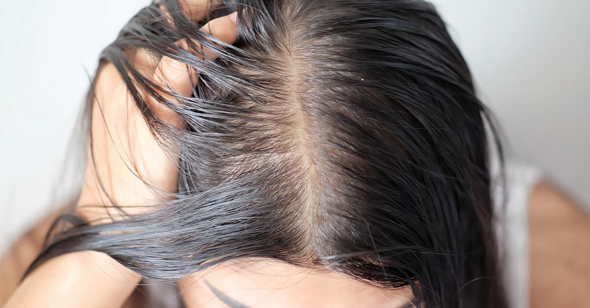 Os perigos ocultos do cabelo sujo: doenças e problemas de pele