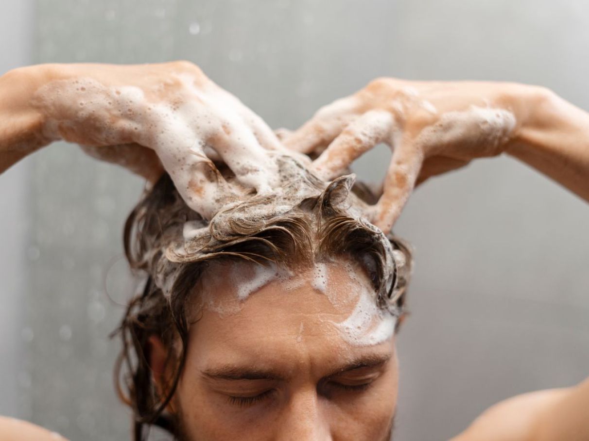 Os perigos ocultos do cabelo sujo: doenças e problemas de pele