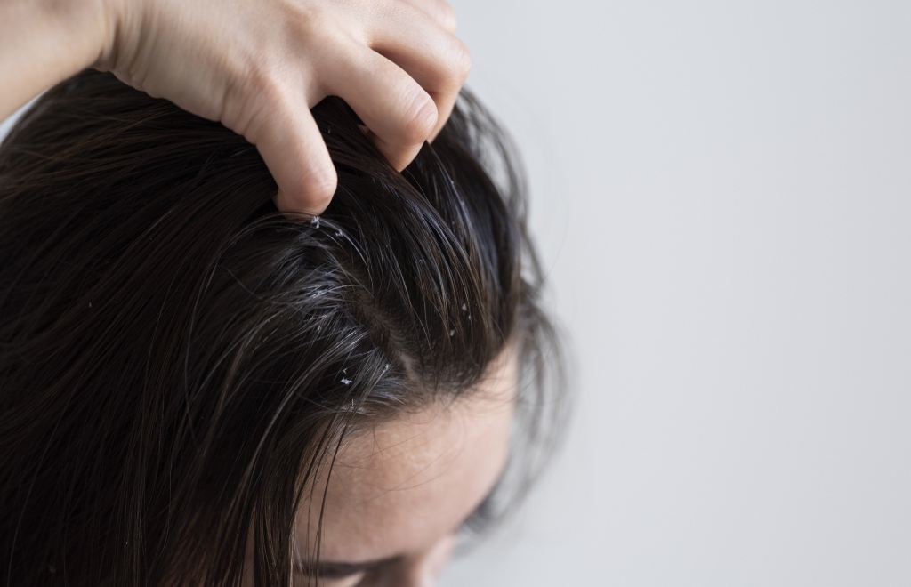 Cabelo sujo e química: o guia definitivo para coloração e descoloração