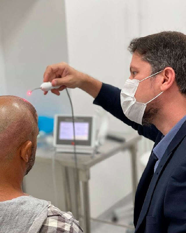 Prótese Capilar em Duque de Caxias: Soluções para Calvície Masculina e Feminina