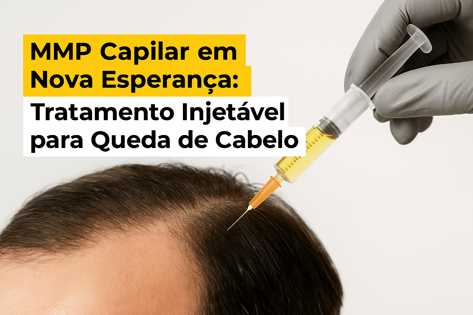 Dermatologistas Tricologistas em Caxias: Diagnóstico e Tratamento da Queda de Cabelo