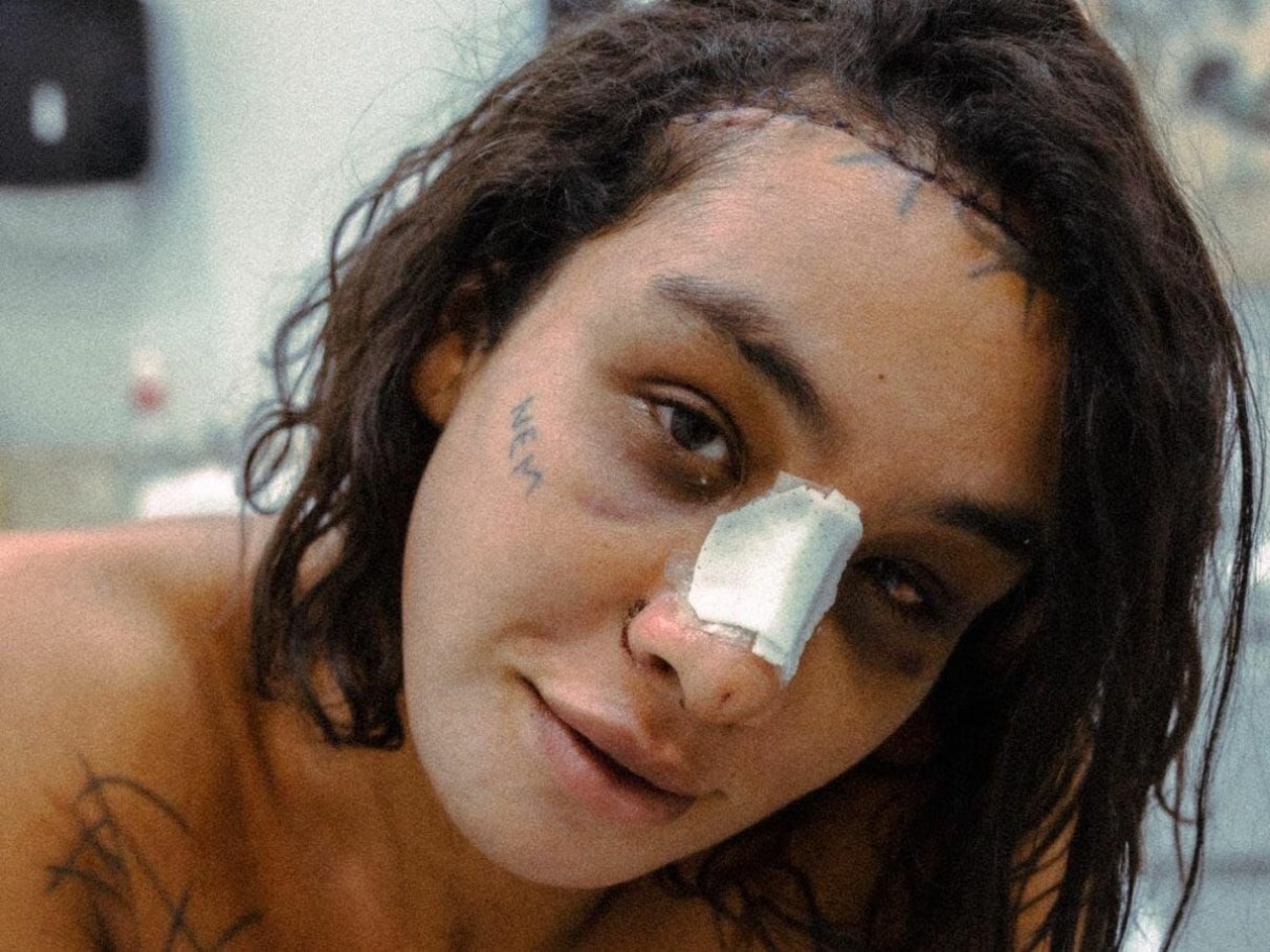 Dra. Patricia Marques e a Frontoplastia: Conheça a especialista em São Paulo