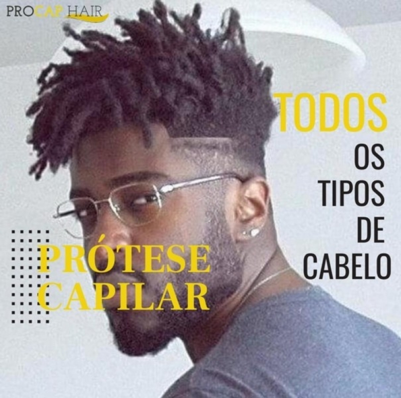 Como Escolher a Melhor Clínica de Prótese Capilar em São Paulo