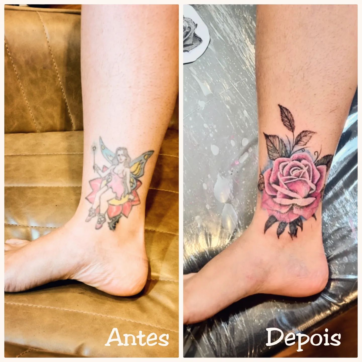 cover up ou remoção a laser qual o melhor