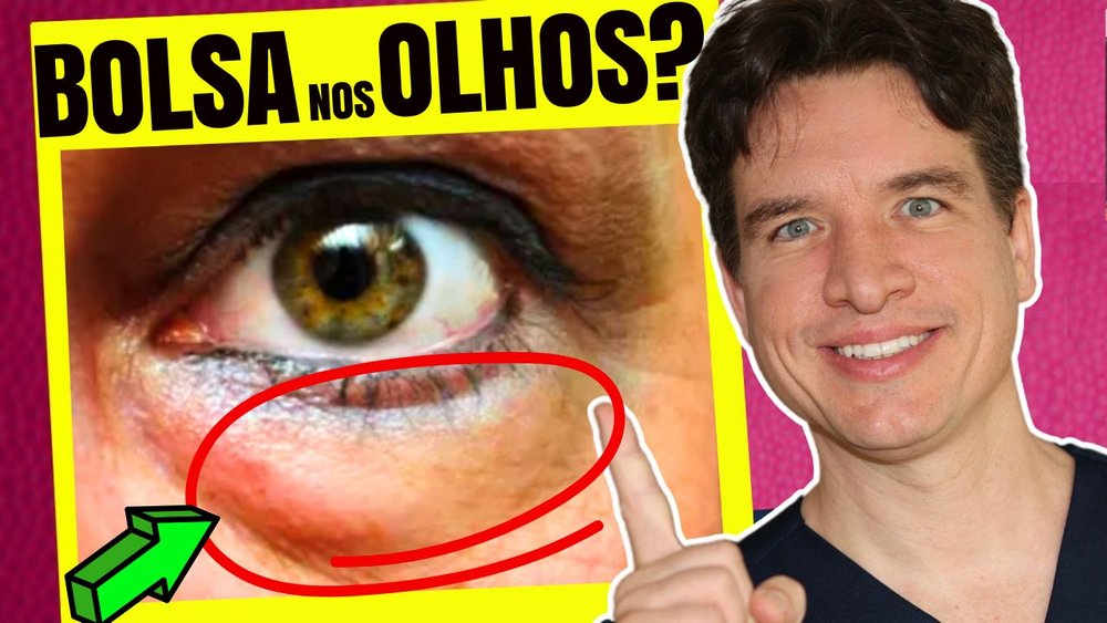 melhores dicas para desinchar os olhos rapidamente
