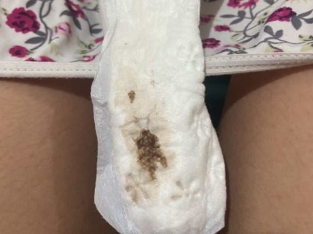 como identificar sangramento de nidação vs menstruação