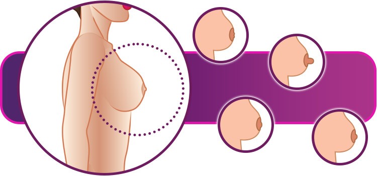 como identificar meu tipo de mamilo