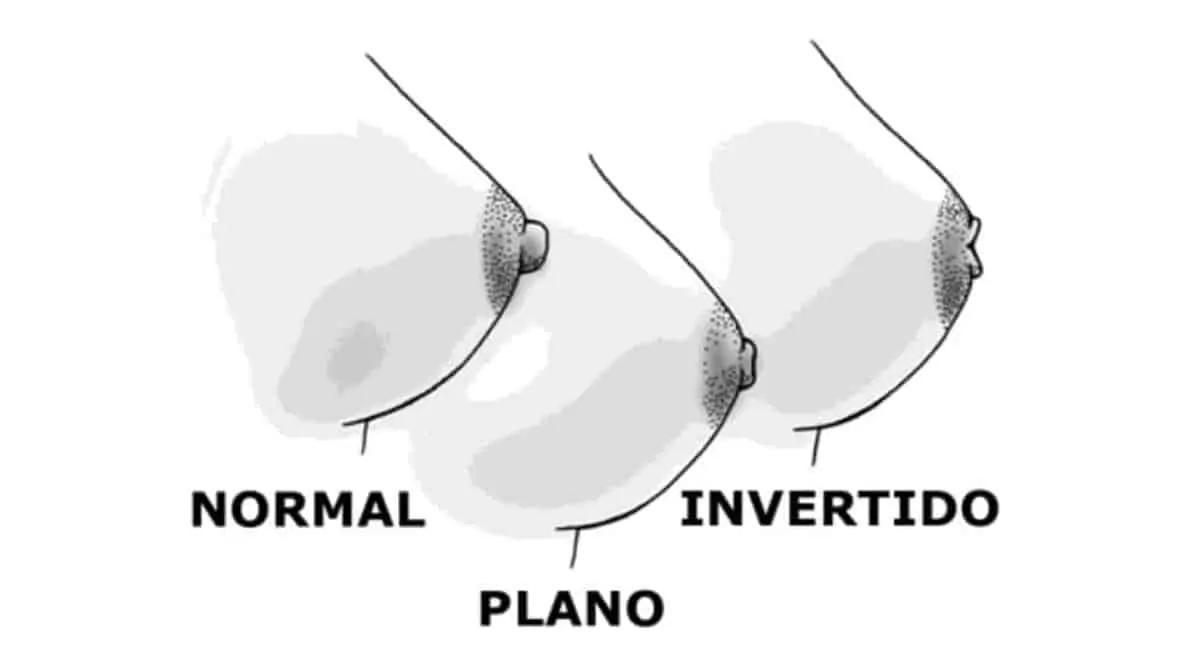 quais os tipos de mamilos que existem