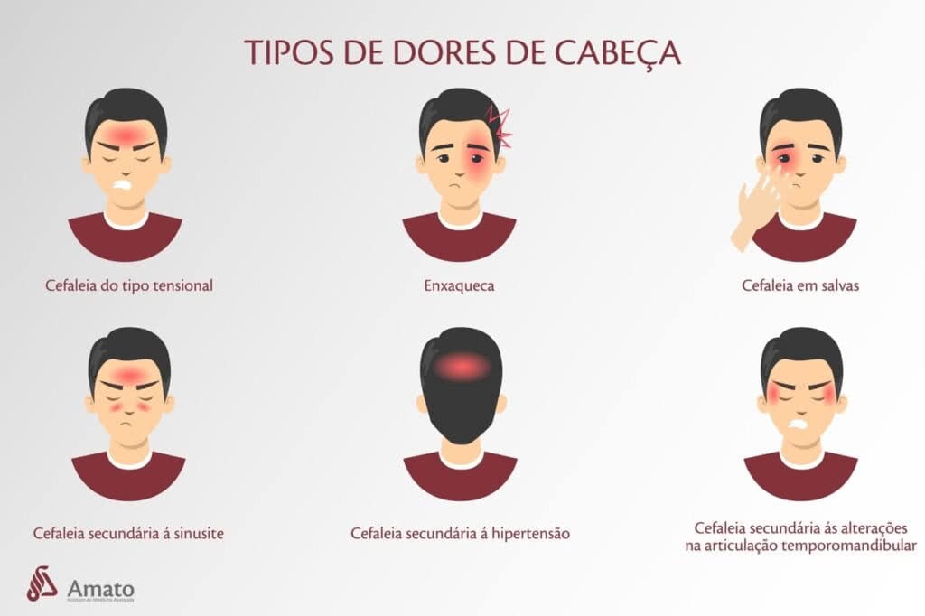 como diferenciar dor de cabeça tensional de enxaqueca