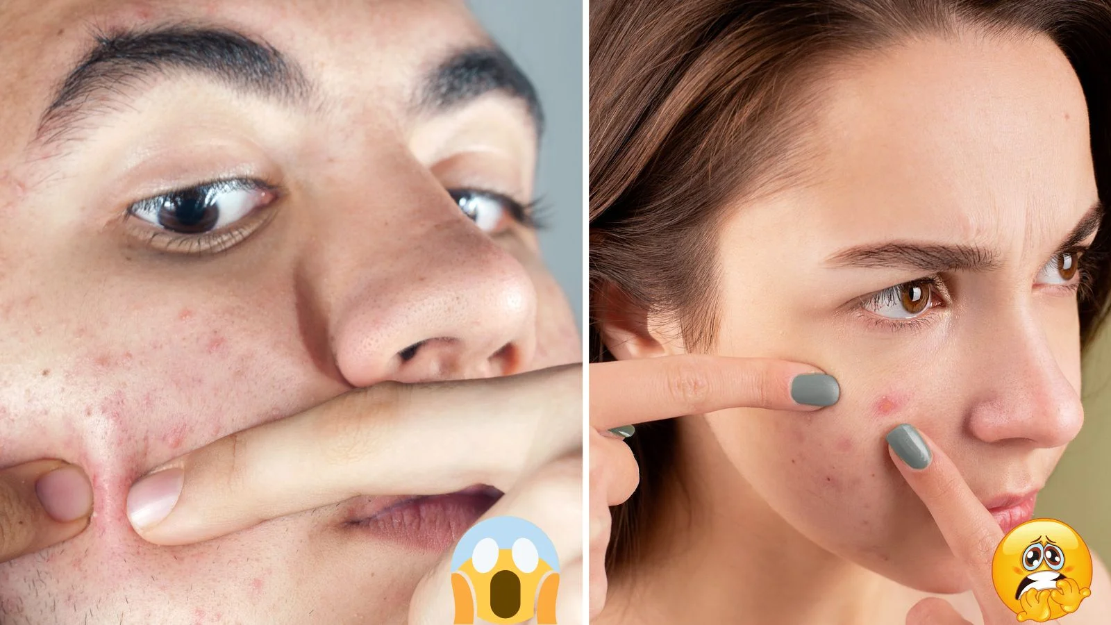 melhores rotinas de skincare para pele com espinhas