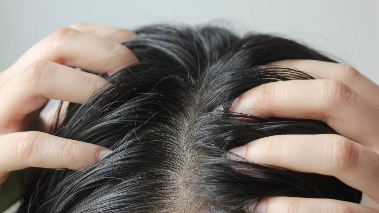 cabelo oleoso o que fazer