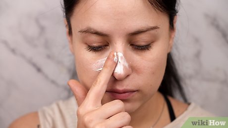 como eliminar hematomas