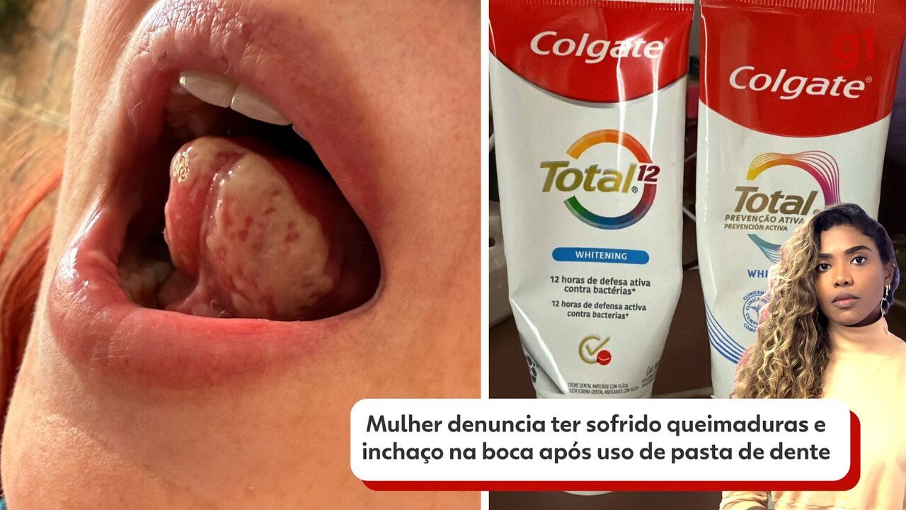 acelerar cicatrização de hematomas