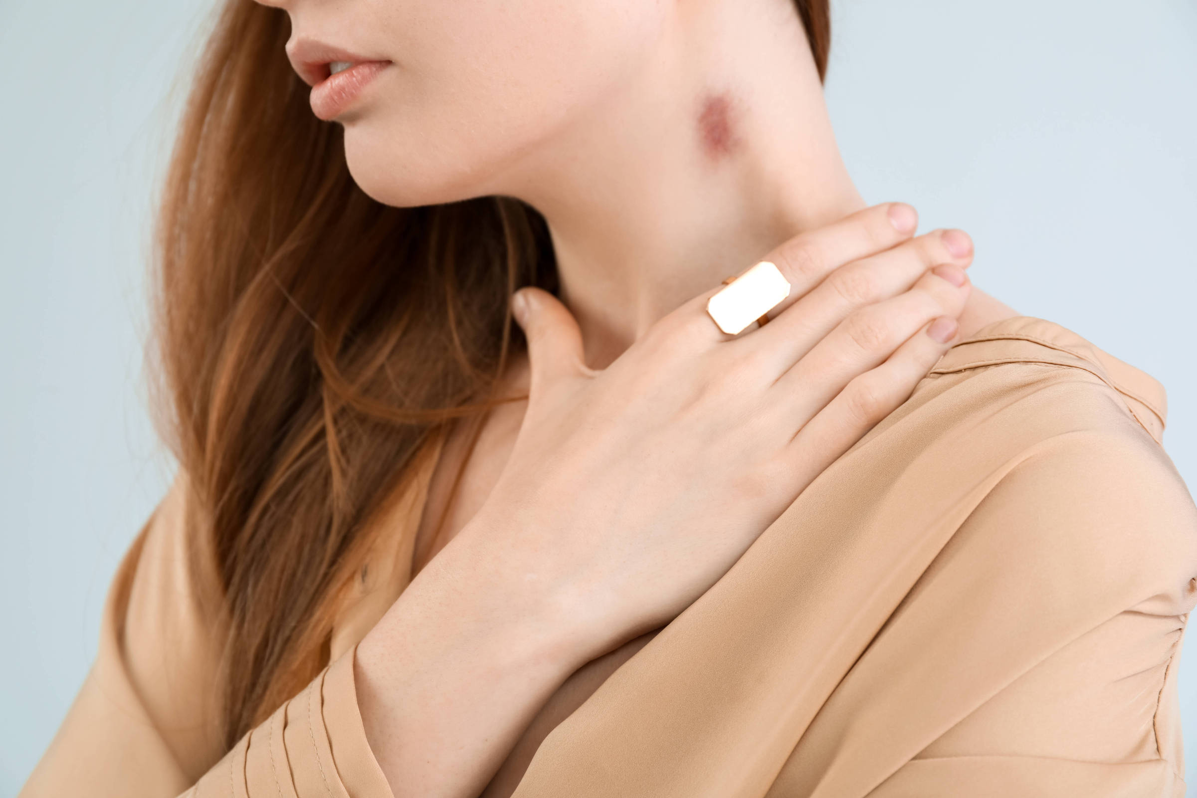 cobrir hematoma com maquiagem