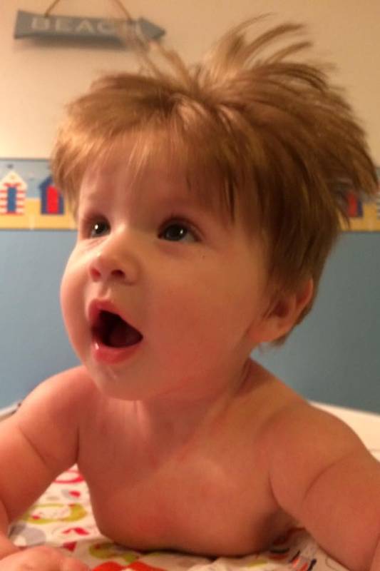 Quando o Cabelo do Bebê Começa a Cair? Entenda a Estabilização Capilar