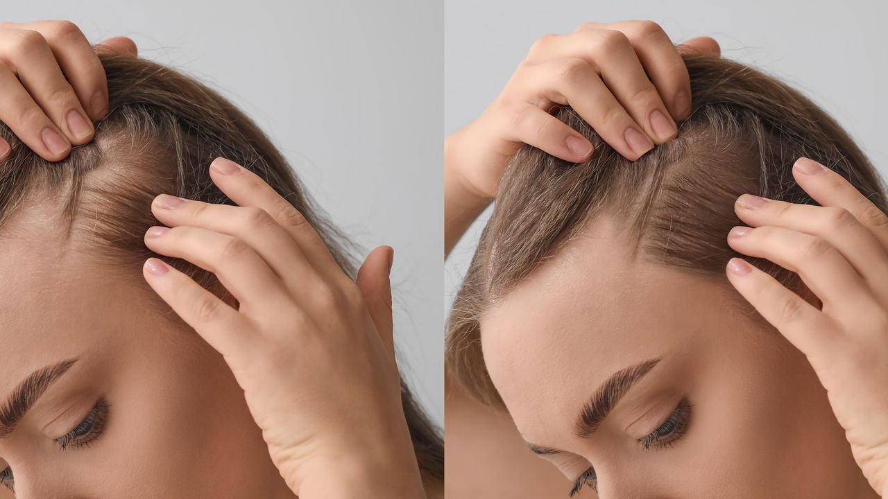 Guia Completo: Massagem Capilar para Estimular o Crescimento e a Circulação