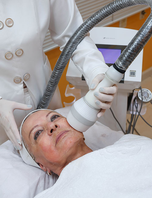 criofrequência facial