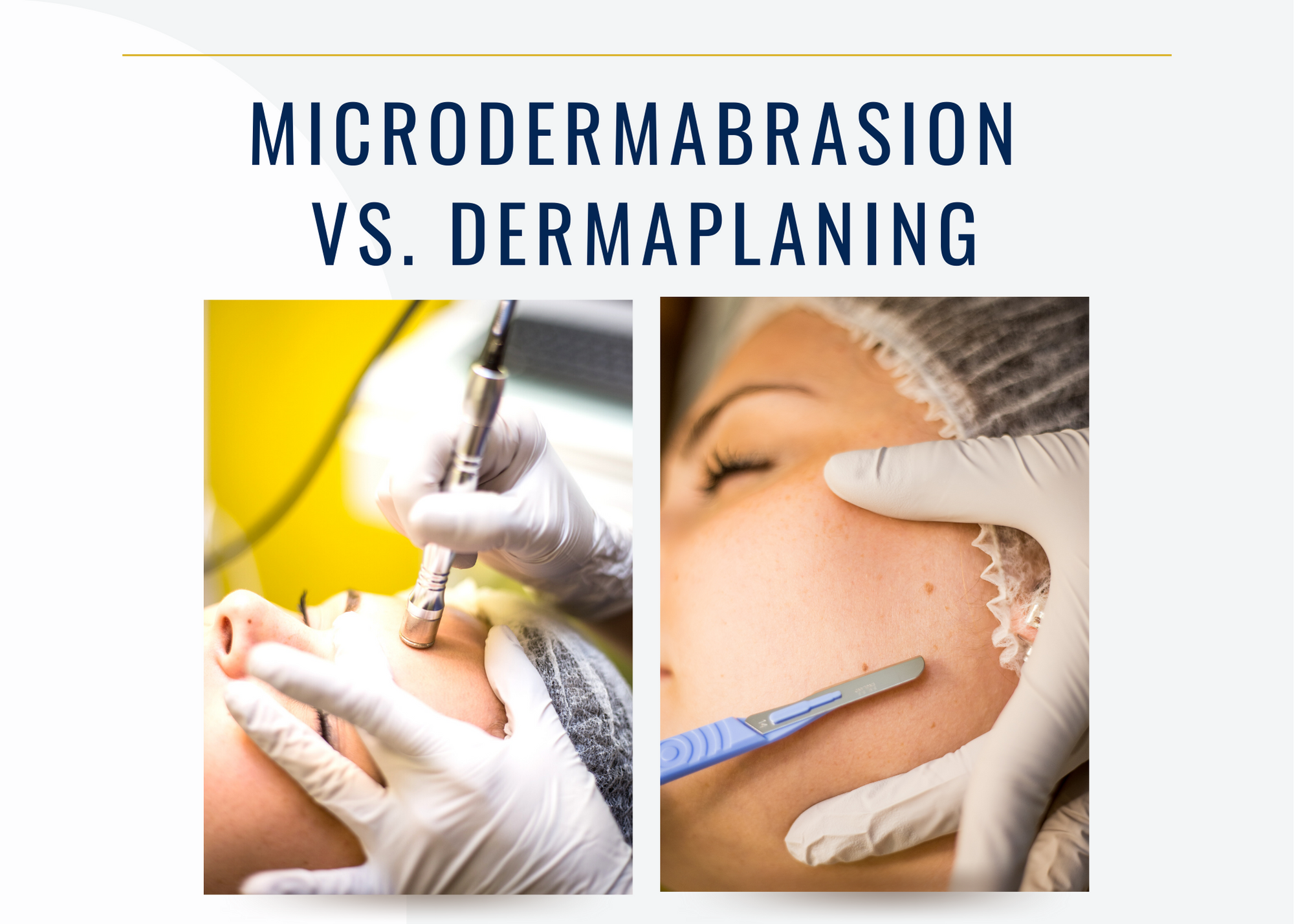 dermaplaning ou microdermoabrasão qual o melhor para você