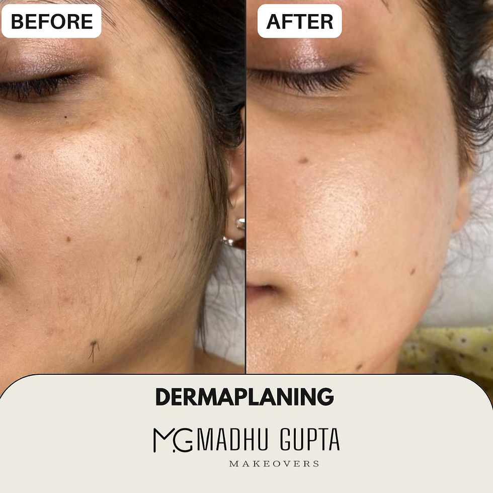 7 benefícios do dermaplaning para uma pele impecável